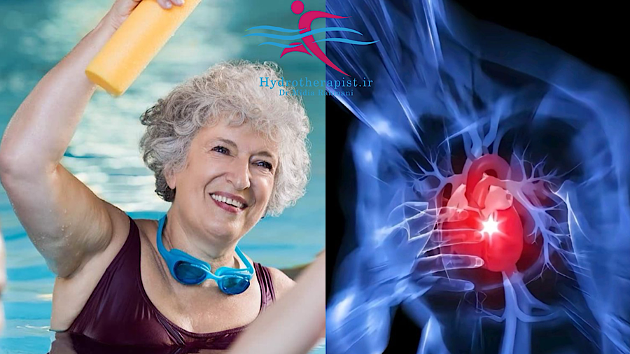 اثرات آب‌درمانی بر بیماران قلبی و پس از انجام آنژیوگرافی و جراحی قلب باز